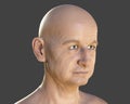 Portrait of a healthy middle age man without hairs with serious and confident face expression, isolated on grey background