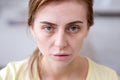 Portrait of a pale exhausted woman Royalty Free Stock Photo