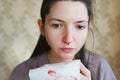 Portrait of serious with caucasian woman with nosebleed. Pensive woman with with a serious illness