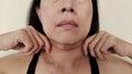 The Flabbiness adipose sagging skin under the neck, wrinkles and flabby skin under the chin, neck wattle of the woman. Royalty Free Stock Photo