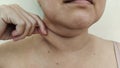 The flabbiness adipose sagging and wrinkles under the neck, cellulite and flabby skin under the chin. Royalty Free Stock Photo