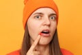 Portrait of sick shocked woman wearing orange jumper and beanie hat standing isolated over yellow background, has oral herpes,