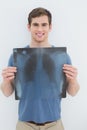 Portrait of a smiling young man holding lung xray Royalty Free Stock Photo