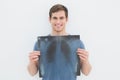 Portrait of a smiling young man holding lung xray Royalty Free Stock Photo