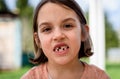 Portrait of toothless child girl missing milk and permanent teeth