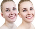 Portrait of woman before and after retouch.