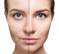 Portrait of woman before and after retouch.