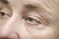 wrinkled face of elderly mature middle aged woman,female eyes with dry skin.cosmetology,skin care