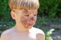 Portrait of a 5 year old boy with a hurt and dirty face. The boy is upset by the injustice.