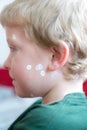 Portrait of a young blond boy with chicken pox and white ointment Royalty Free Stock Photo