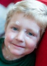 Portrait of a young blond boy with chicken pox and white ointment Royalty Free Stock Photo