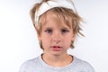 Portrait young caucasian cute boy blond hair with trauma injury and bandage head. Isolated on white background. Sick sad Royalty Free Stock Photo