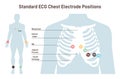 Position of ECG chest leads. Cardiovascular checkup with cardiogram.