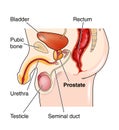 Position of the prostate gland