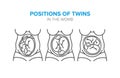 Position of twins in the womb