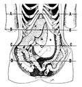 Position of the Viscera in the Condition of Visceroptosis, vintage illustration