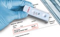 Positive antigen test result by using rapid self testing device for COVID-19