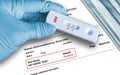 Positive antigen test result by using rapid self testing device for HIV Royalty Free Stock Photo