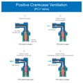 Positive Crankcase Ventilation PCV Valve.
