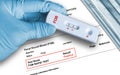 Positive FOB rapid test result by using rapid testing cassette to detect hidden blood in feces Royalty Free Stock Photo