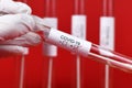Positive medical test tube sample for Coronavirus with label Covid-19 held by hand in rubber glove with other blury tubes