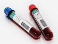 Positive and negative blood samples in vials with HIV test labels. 3D illustration Royalty Free Stock Photo