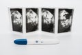 Positive pregnancy test on ultrasound photo. Positive pregnancy test result on a white background.