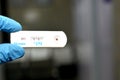 Positive result of Hepatitis B surface antigen and negative HCV and HIV AIDS in a rapid test cassette kit