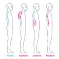 Posture and back problems spine infographic