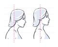 Posture correction neck position correct posture vector illustration