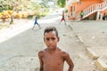 Caracas, Venezuela - 20 june 2018: potrait of malnourished venezuelan child playing in the streets half during economic
