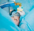 Pre oxygenation for general anesthesia. Surgery equipment. Royalty Free Stock Photo