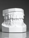 Precision Dental Impression Cast Model for Orthodontics Royalty Free Stock Photo