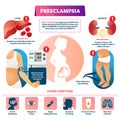 Preeclampsia vector illustration. Labeled pregnancy complication scheme. Royalty Free Stock Photo