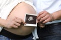 Pregnancy: couple holding ultrasonic image of baby