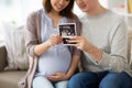 Couple with baby ultrasound images at home Royalty Free Stock Photo