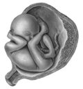 Pregnancy - Fetus - Normal In Utero Royalty Free Stock Photo