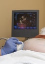 Pregnancy Sonogram