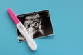 Pregnancy test and baby ultrasound photo scan photo on blue background. Royalty Free Stock Photo