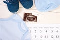 Pregnancy test, ultrasound scan of baby, clothing for newborn and calendar, expecting for baby Royalty Free Stock Photo