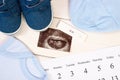 Pregnancy test, ultrasound scan of baby, clothing for newborn and calendar, expecting for baby Royalty Free Stock Photo