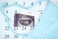 Pregnancy test, ultrasound scan of baby and clothing for newborn on calendar, expecting for baby Royalty Free Stock Photo