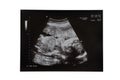 Pregnancy Ultrasound Scan Image Royalty Free Stock Photo