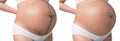 Pregnant Asian woman have Stretch marks on belly and clean belly, Isolated on white background, With clipping path, Before and Royalty Free Stock Photo