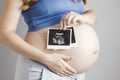 Pregnant belly woman on grey studio background holding in hands card with ultrasound black and white scan, pregnancy concept