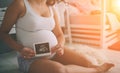 Pregnant couple holding ultrasound scan. Concept of Pregnancy health care Royalty Free Stock Photo