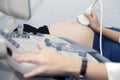 Pregnant girl doing on ultrasound examination Royalty Free Stock Photo