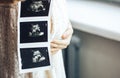 Pregnant girl holding photos of ultrasound result in hands, near window with sunlight Royalty Free Stock Photo