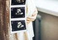 Pregnant girl holding photos of ultrasound result in hands Royalty Free Stock Photo