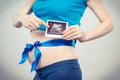 Pregnant woman with blue ribbon showing ultrasound scan of baby, concept of expecting for newborn Royalty Free Stock Photo